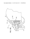 SUSPENSION FOR WHEELED VEHICLES diagram and image