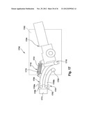 WHEELCHAIR SUSPENSION diagram and image