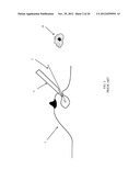 MARGIN ASSESSMENT OF EX-VIVO SAMPLE diagram and image