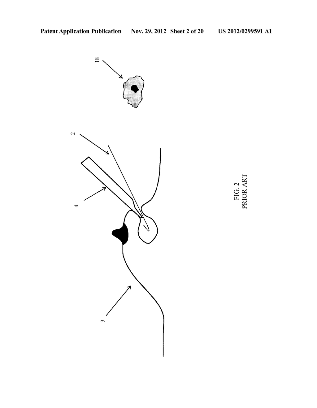 MARGIN ASSESSMENT OF EX-VIVO SAMPLE - diagram, schematic, and image 03