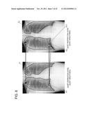 CHEST DIAGNOSTIC SUPPORT INFORMATION GENERATION SYSTEM diagram and image