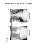 CHEST DIAGNOSTIC SUPPORT INFORMATION GENERATION SYSTEM diagram and image