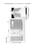 CHEST DIAGNOSTIC SUPPORT INFORMATION GENERATION SYSTEM diagram and image