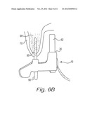 SENSOR POSITIONING AND STABILIZING DEVICE diagram and image