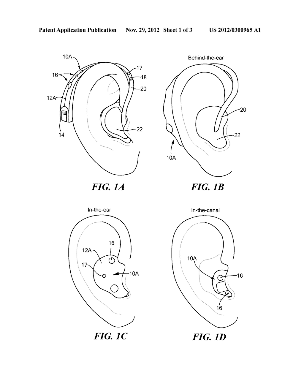 Hearing Instrument Controller - diagram, schematic, and image 02