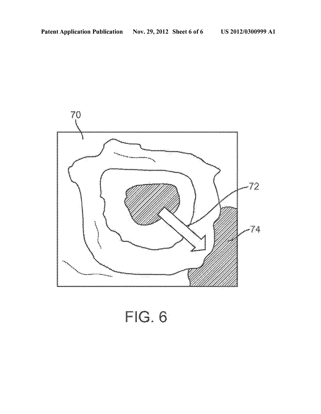 METHOD AND DEVICE FOR EXAMINING OR IMAGING AN INTERIOR SURFACE OF A CAVITY - diagram, schematic, and image 07