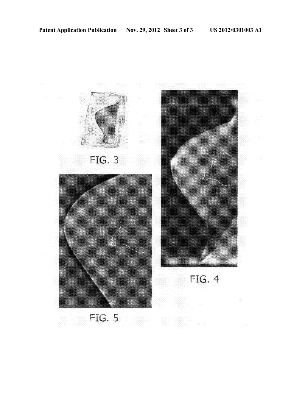 RECONSTRUCTING AN OBJECT OF INTEREST - diagram, schematic, and image 04