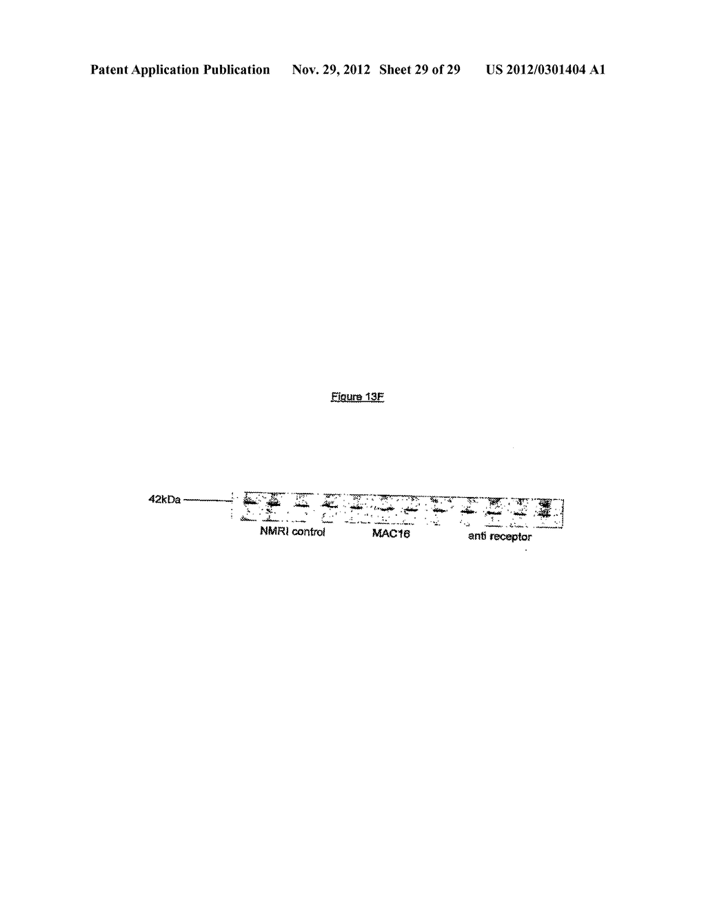 TREATMENT OF CACHEXIA - diagram, schematic, and image 30