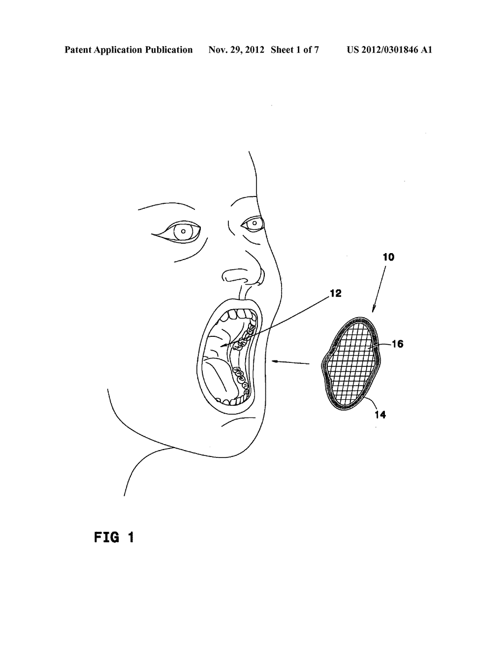 DENTAL TREATMENT AID DEVICE - diagram, schematic, and image 02