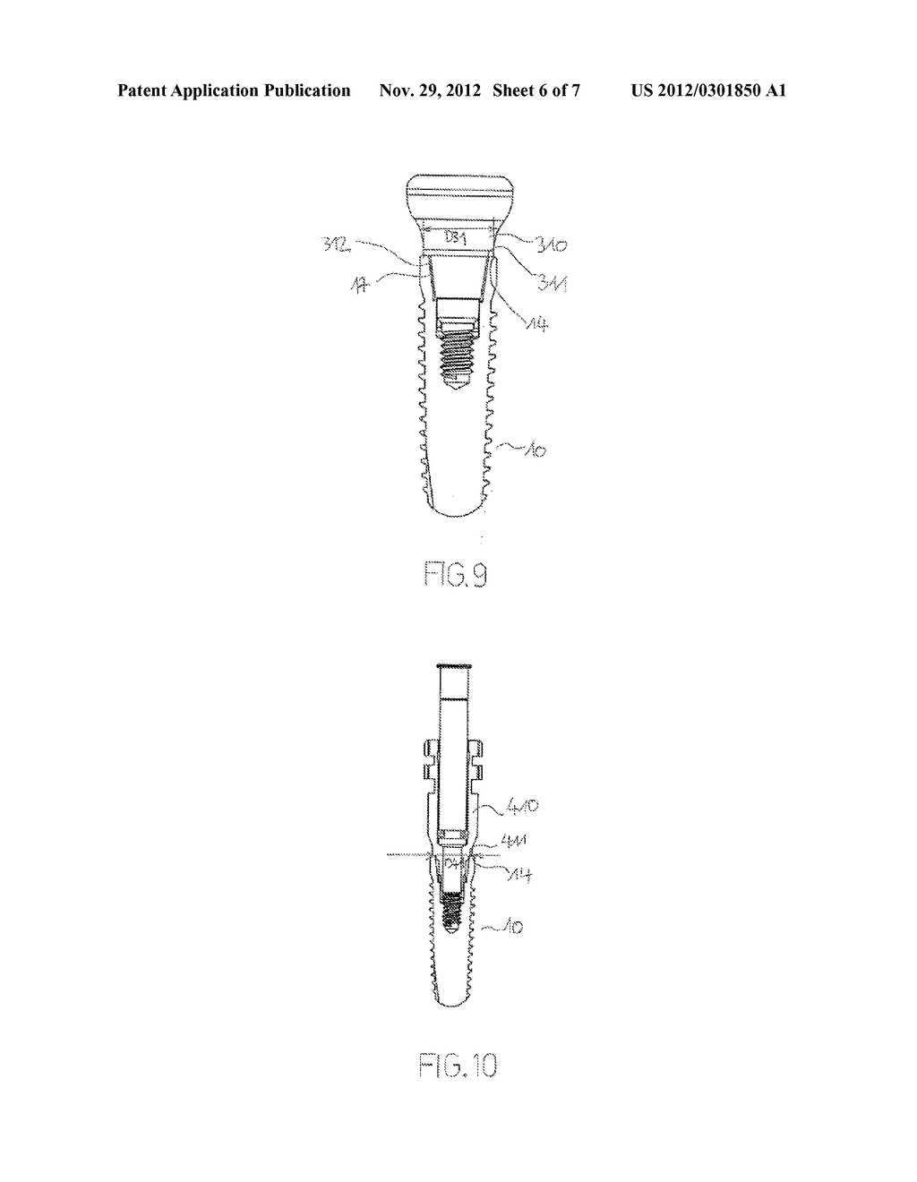 Dental Implant, Abutment for a Dental Implant and Combination Thereof and     an Implant Set - diagram, schematic, and image 07