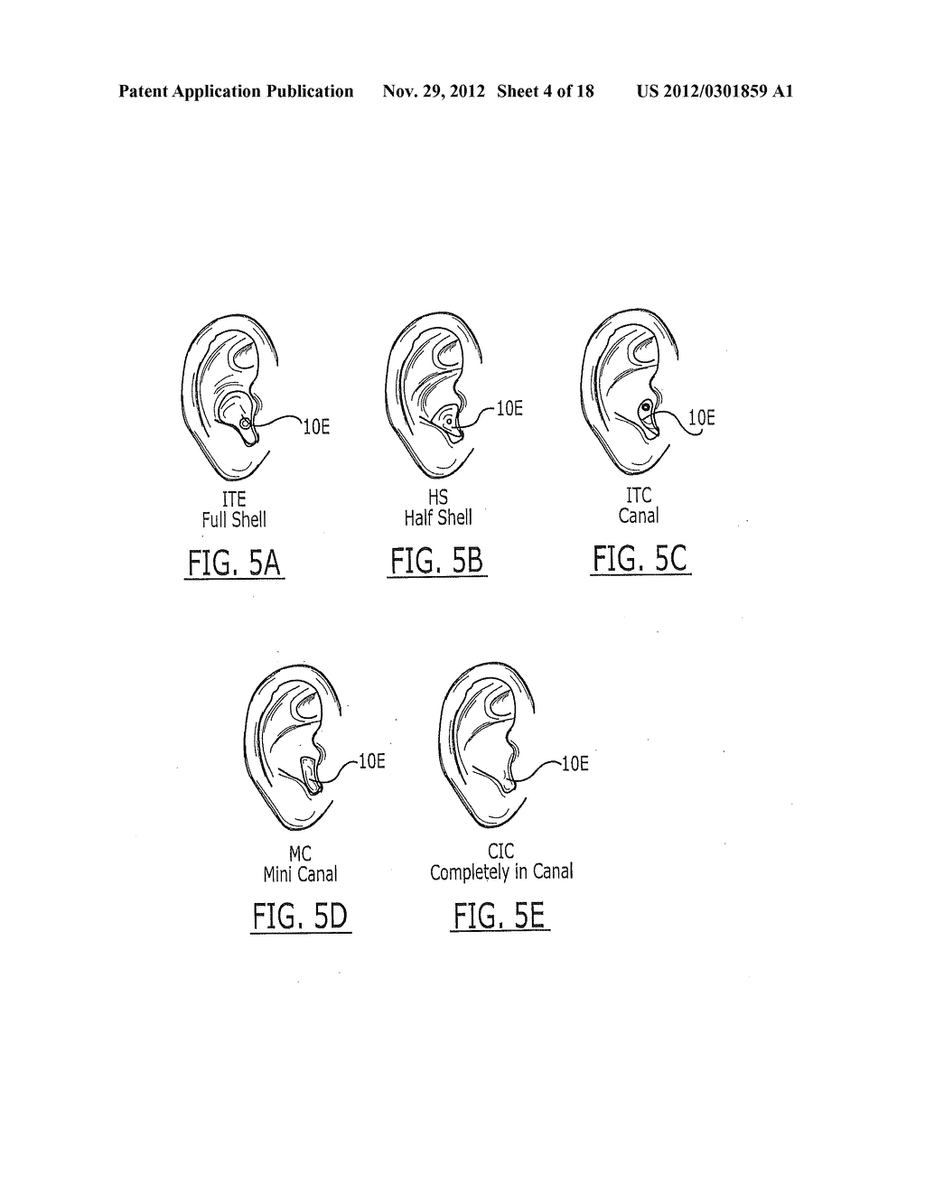 FREQUENCY ALTERED FEEDBACK FOR TREATING NON-STUTTERING PATHOLOGIES - diagram, schematic, and image 05