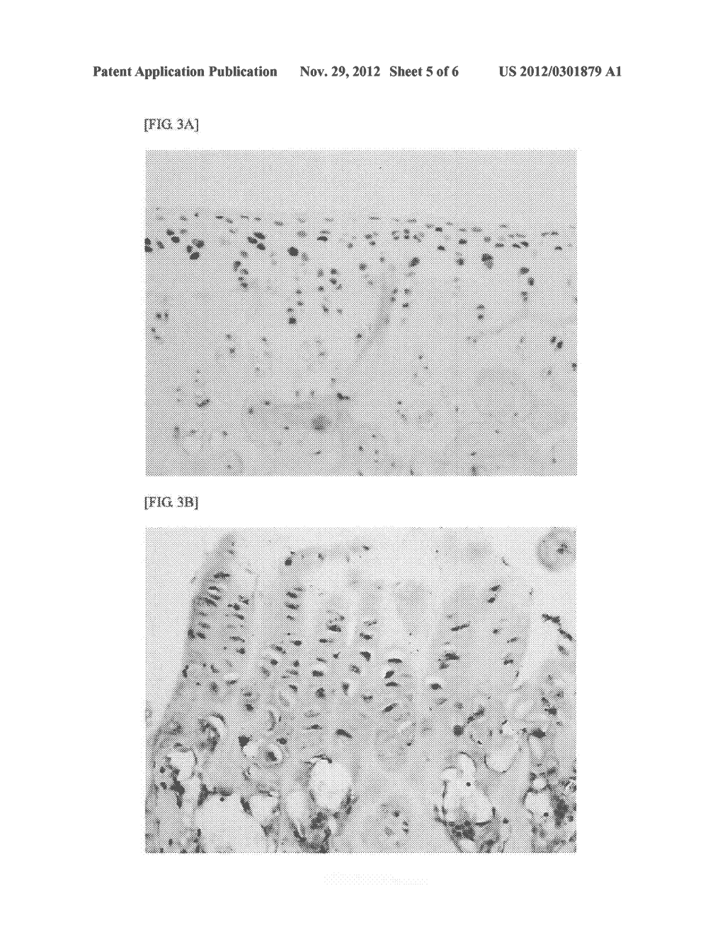 NOVEL USE OF CA-125 - diagram, schematic, and image 06