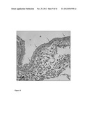 BIOARTIFICIAL PROXIMAL TUBULE SYSTEMS AND METHODS OF USE diagram and image