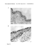 BIOARTIFICIAL PROXIMAL TUBULE SYSTEMS AND METHODS OF USE diagram and image