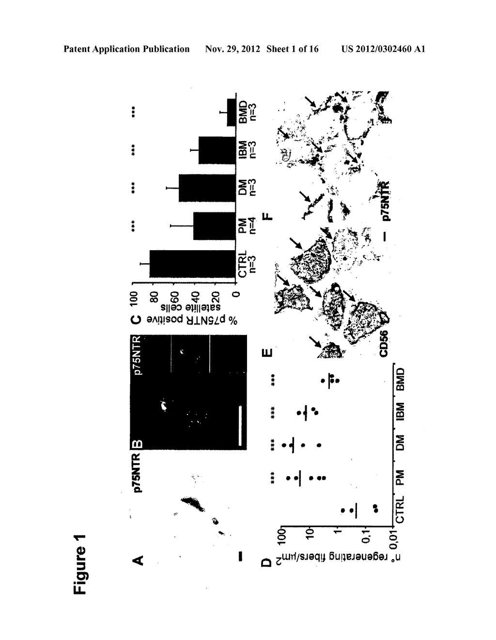 Use of Low Affinity Neurotrophin Receptor P75 As Marker for High     Differentiation Potential Muscle Stem Cells, Muscle Satellite Cells, And     Degenerative Skeletal Muscle Diseases - diagram, schematic, and image 02