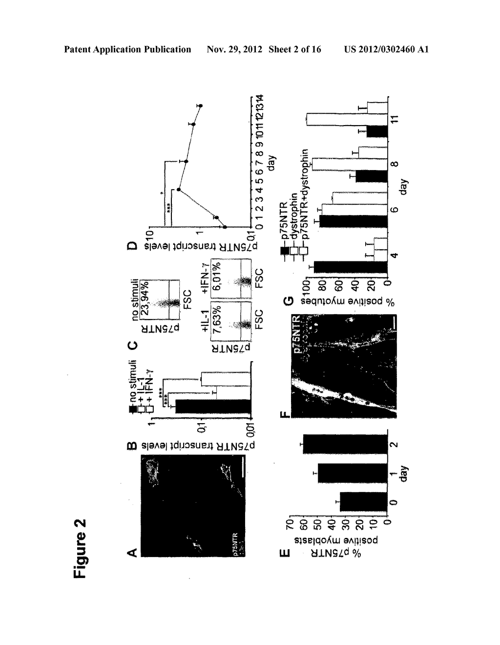 Use of Low Affinity Neurotrophin Receptor P75 As Marker for High     Differentiation Potential Muscle Stem Cells, Muscle Satellite Cells, And     Degenerative Skeletal Muscle Diseases - diagram, schematic, and image 03