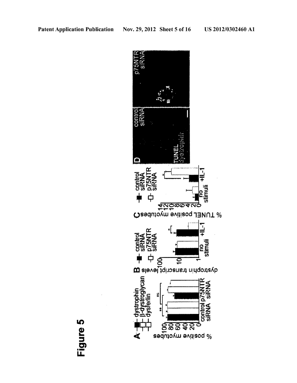 Use of Low Affinity Neurotrophin Receptor P75 As Marker for High     Differentiation Potential Muscle Stem Cells, Muscle Satellite Cells, And     Degenerative Skeletal Muscle Diseases - diagram, schematic, and image 06