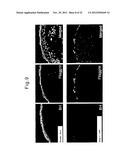 METHOD FOR SCREENING AMELIORANTS OF DRY SKIN CAUSED BY ATOPIC DERMATITIS     USING BLEOMYCIN HYDROLASE ACTIVITY AS INDICATOR diagram and image