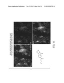 Imaging Agents for Detecting Neurological Dysfunction diagram and image