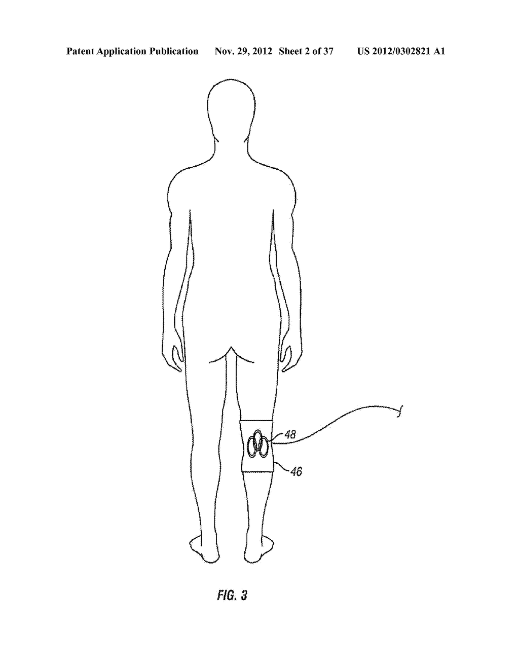 METHOD AND APPARATUS FOR ELECTROMAGNETIC STIMULATION OF NERVE, MUSCLE, AND     BODY TISSUES - diagram, schematic, and image 03