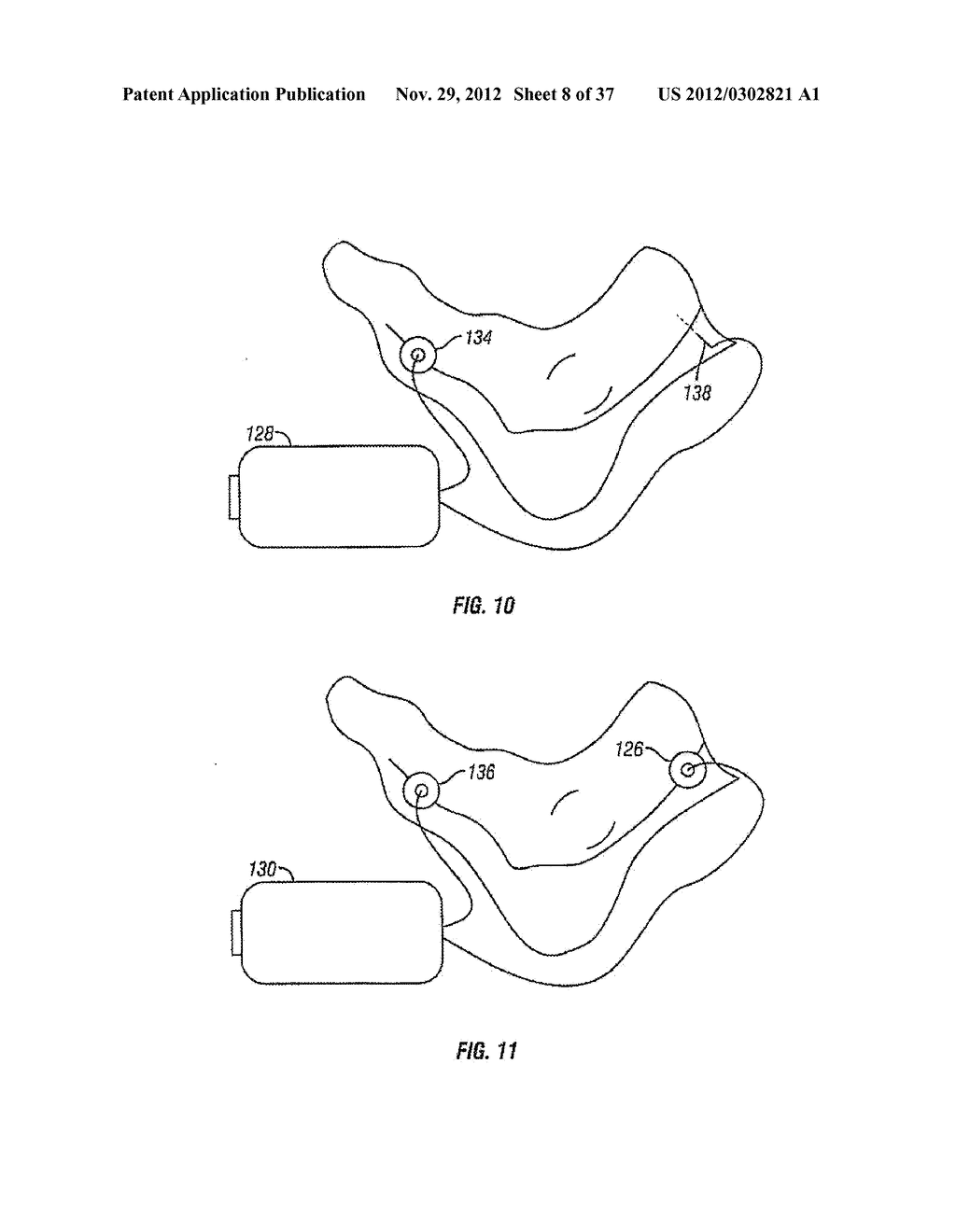 METHOD AND APPARATUS FOR ELECTROMAGNETIC STIMULATION OF NERVE, MUSCLE, AND     BODY TISSUES - diagram, schematic, and image 09