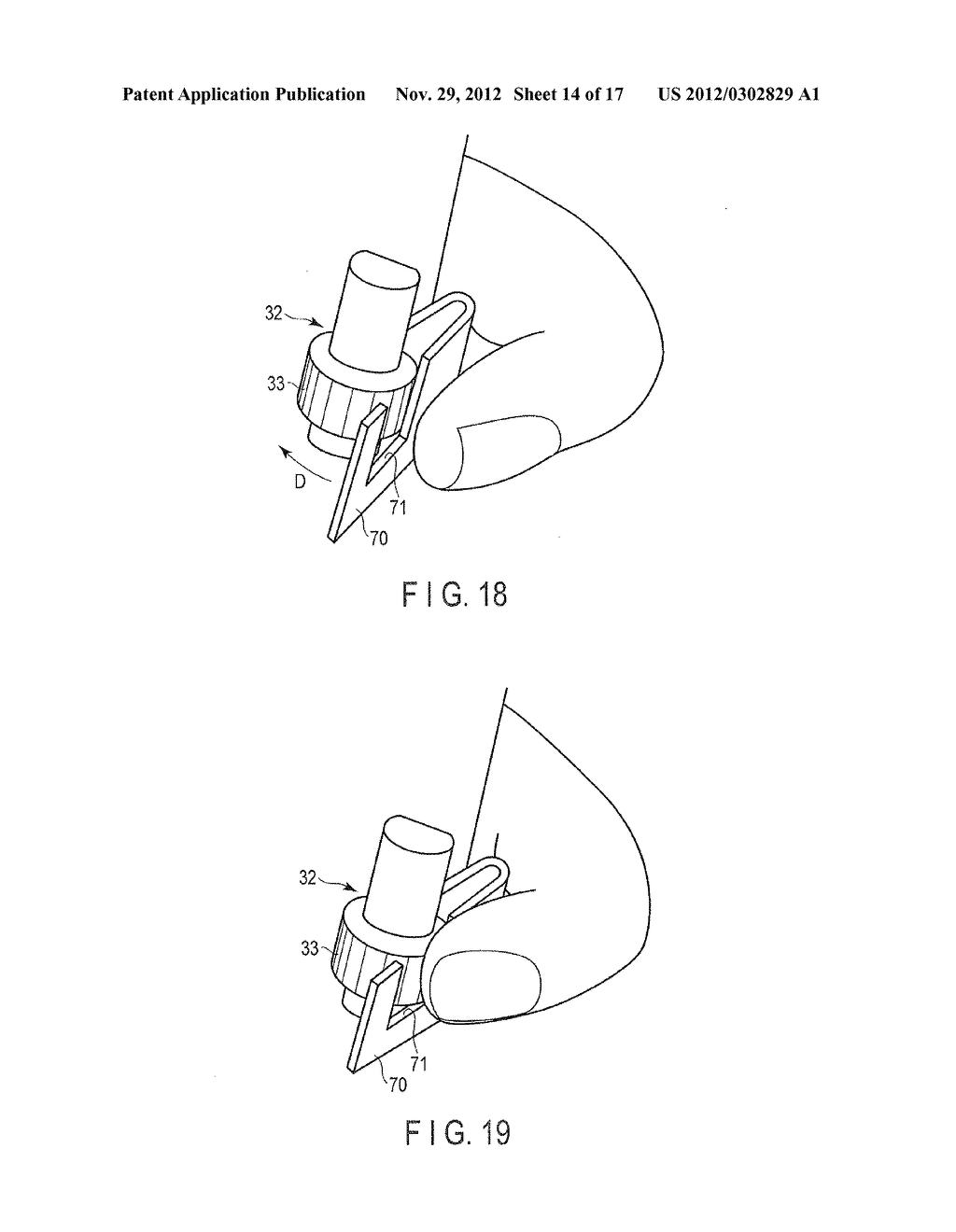 ENDOSCOPE - diagram, schematic, and image 15