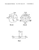 System for Sleep Stage Determination Using Frontal Electrodes diagram and image