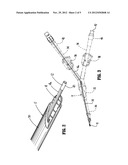 Inter Dialytic Monitoring Device diagram and image