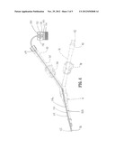 Inter Dialytic Monitoring Device diagram and image