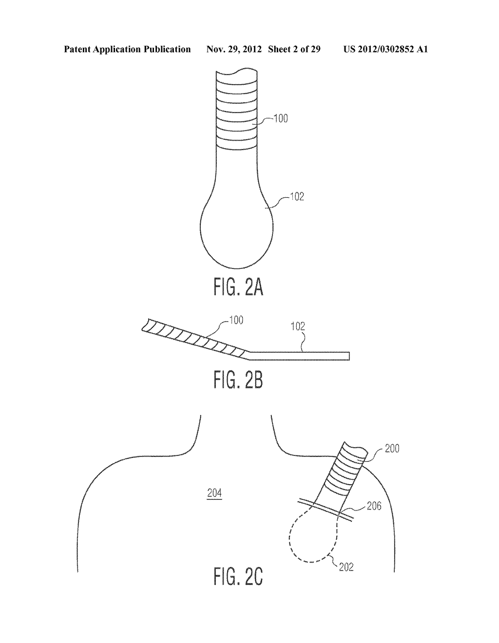 IMPLANTABLE MEDICAL DEVICE REMOVAL/INSERTION TOOL - diagram, schematic, and image 03