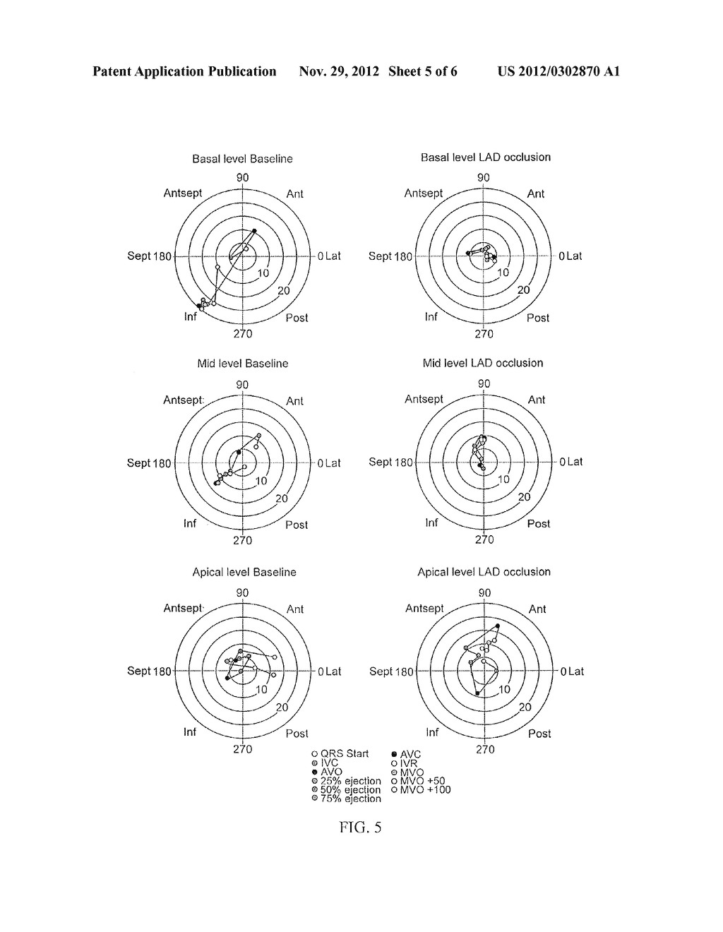 SYSTEM TO QUANTIFY AND VISUALIZE VENTRICULAR ROTATION PATTERN OF THE HEART - diagram, schematic, and image 06