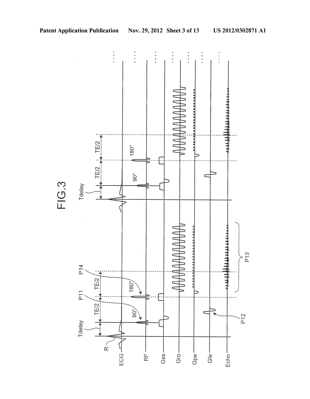 DETERMINING VELOCITY OF CEREBROSPINAL FLUID BY MAGNETIC RESONANCE IMAGING - diagram, schematic, and image 04