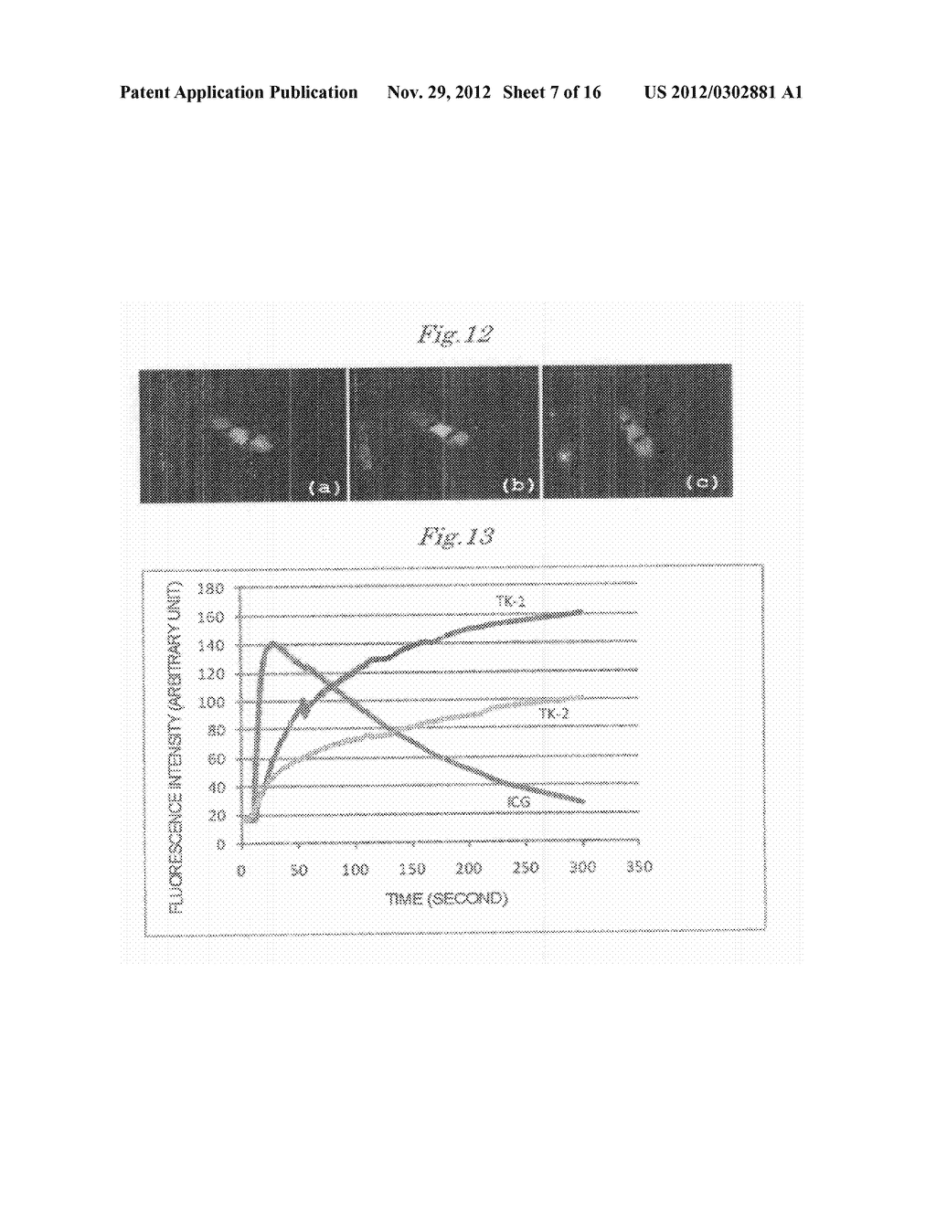 NOVEL INDOCYANINE COMPOUND, SYNTHESIS METHOD AND PURIFICATION METHOD     THEREOF, DIAGNOSTIC COMPOSITION USING THE INDOCYANINE COMPOUND, AND     DEVICE FOR MEASURING BIOKINETICS AND DEVICE FOR VISUALIZING CIRCULATION     USING THE DIAGNOSTIC COMPOSITION - diagram, schematic, and image 08