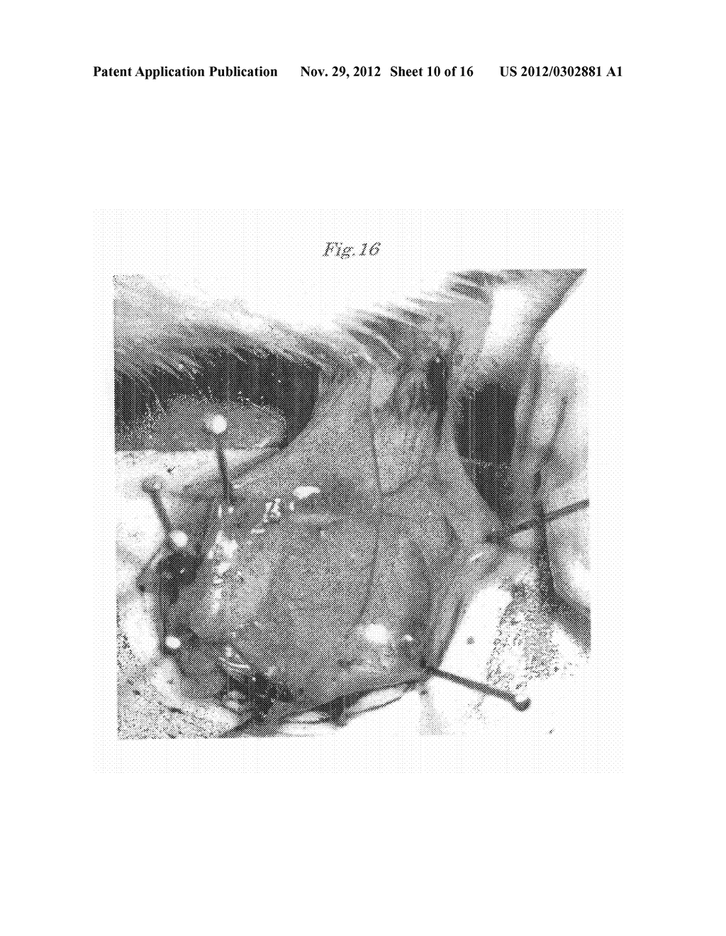 NOVEL INDOCYANINE COMPOUND, SYNTHESIS METHOD AND PURIFICATION METHOD     THEREOF, DIAGNOSTIC COMPOSITION USING THE INDOCYANINE COMPOUND, AND     DEVICE FOR MEASURING BIOKINETICS AND DEVICE FOR VISUALIZING CIRCULATION     USING THE DIAGNOSTIC COMPOSITION - diagram, schematic, and image 11