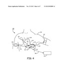 INTEGRATED WIRELESS NON-INVASIVE PERFUSION SENSOR diagram and image