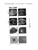 PORTABLE OPTICAL FIBER PROBE-BASED SPECTROSCOPIC SCANNER FOR RAPID CANCER     DIAGNOSIS diagram and image