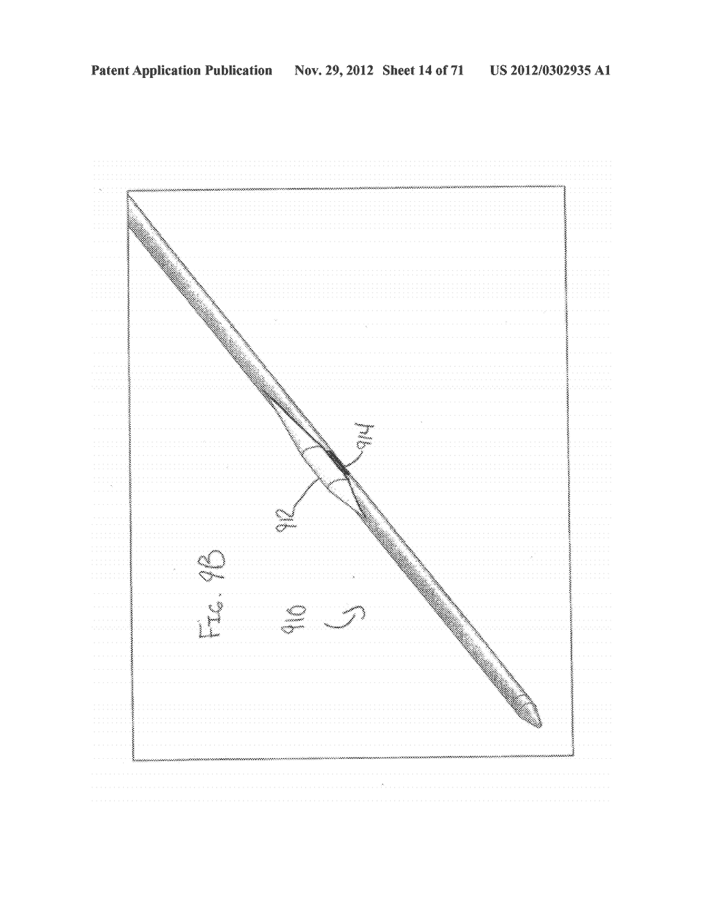 DEVICES AND METHODS FOR FORMING A FISTULA - diagram, schematic, and image 15