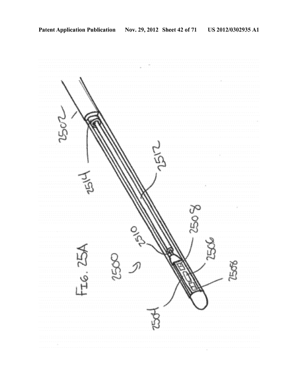 DEVICES AND METHODS FOR FORMING A FISTULA - diagram, schematic, and image 43