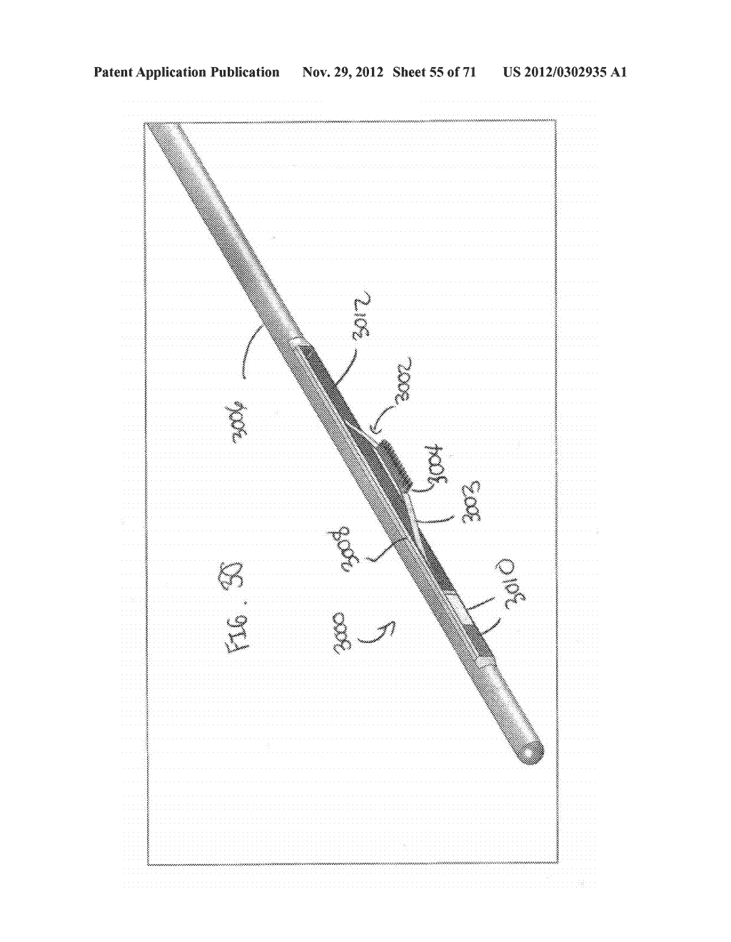 DEVICES AND METHODS FOR FORMING A FISTULA - diagram, schematic, and image 56