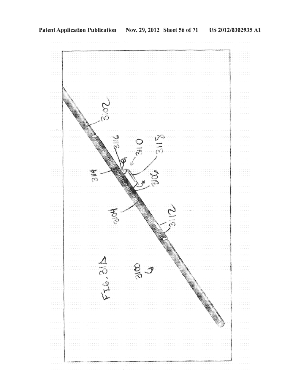 DEVICES AND METHODS FOR FORMING A FISTULA - diagram, schematic, and image 57