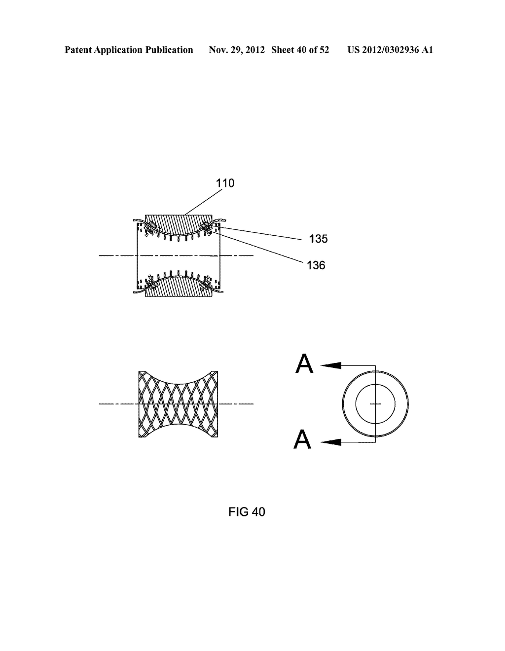 EXTERNAL ANCHORING CONFIGURATIONS FOR MODULAR GASTROINTESTINAL PROSTHESES - diagram, schematic, and image 41