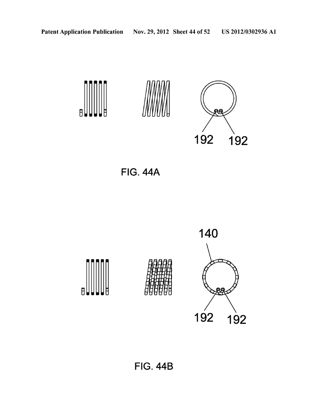 EXTERNAL ANCHORING CONFIGURATIONS FOR MODULAR GASTROINTESTINAL PROSTHESES - diagram, schematic, and image 45