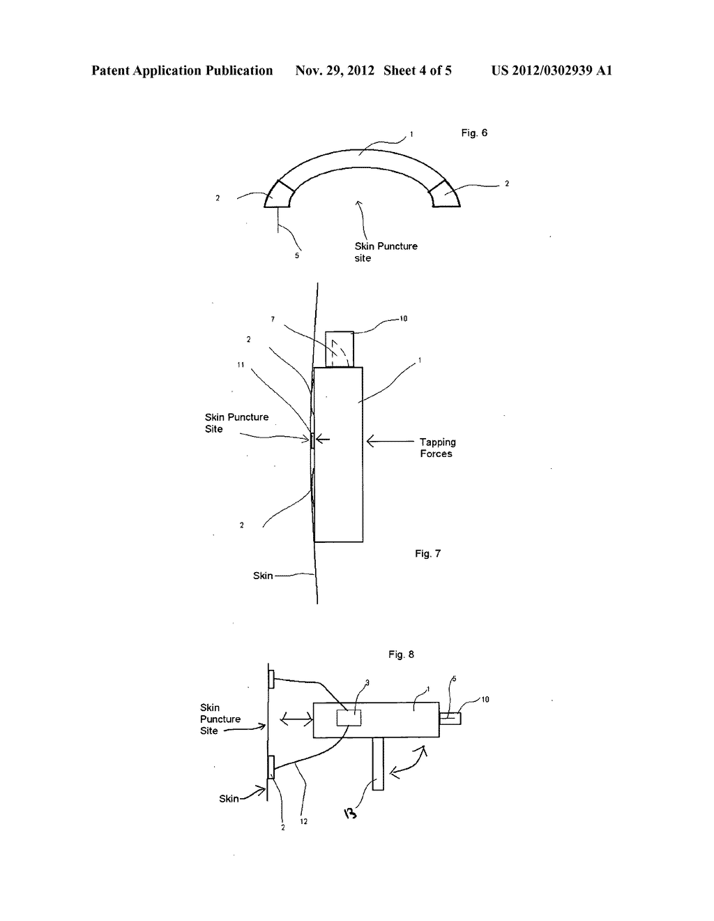 Means and method to painlessly puncture skin - diagram, schematic, and image 05