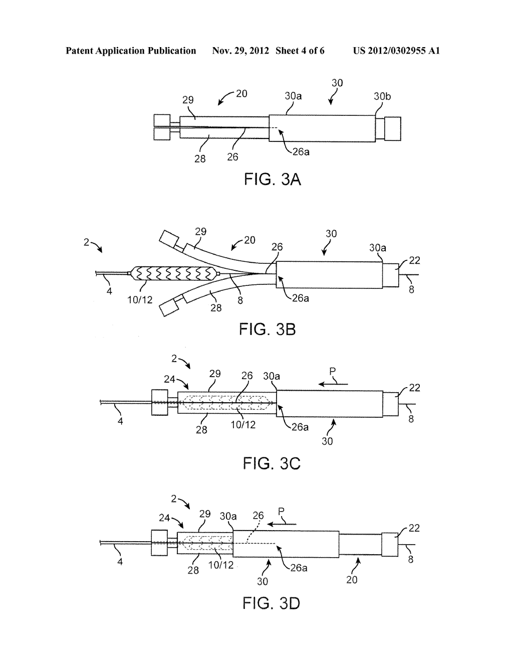 Polymer Scaffold Sheaths - diagram, schematic, and image 05