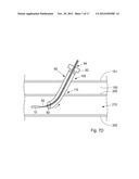 Device, Kit And Method For Closure Of A Body Lumen Puncture diagram and image