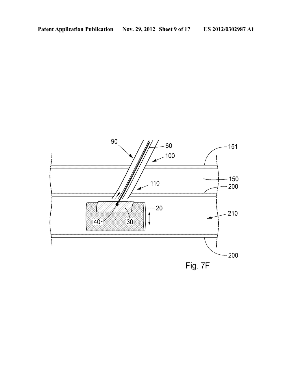 Device, Kit And Method For Closure Of A Body Lumen Puncture - diagram, schematic, and image 10