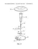 Medical Device Inserters and Processes of Inserting and Using Medical     Devices diagram and image