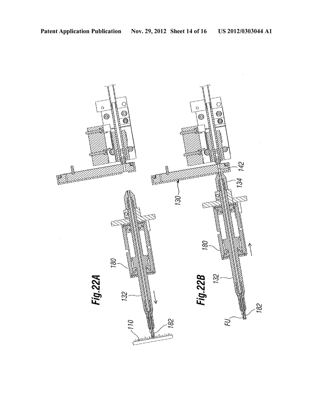 Systems and Methods for Harvesting, Storing, and Implanting Hair Grafts - diagram, schematic, and image 15