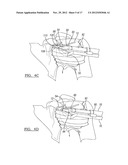 Method and Apparatus for Passing a Suture diagram and image