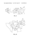 Method and Apparatus for Passing a Suture diagram and image